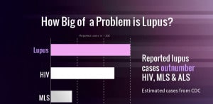 lupus infographic